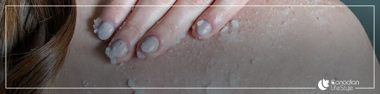 Benefits of salt for the skin