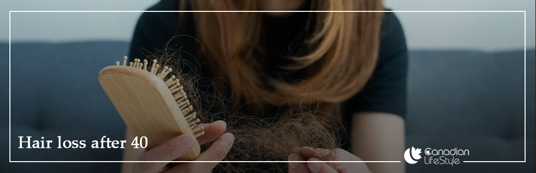 Hair Loss After 40