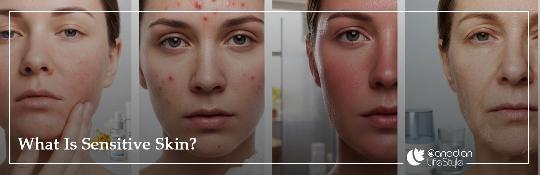 What Is Sensitive Skin? What Is Sensitive Skin?
