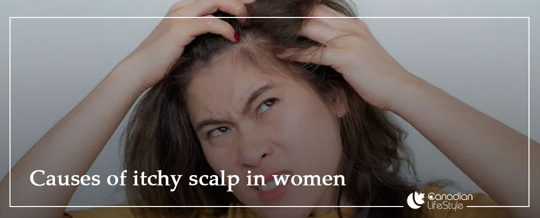 Causes of itchy scalp in women Causes of itchy scalp in women