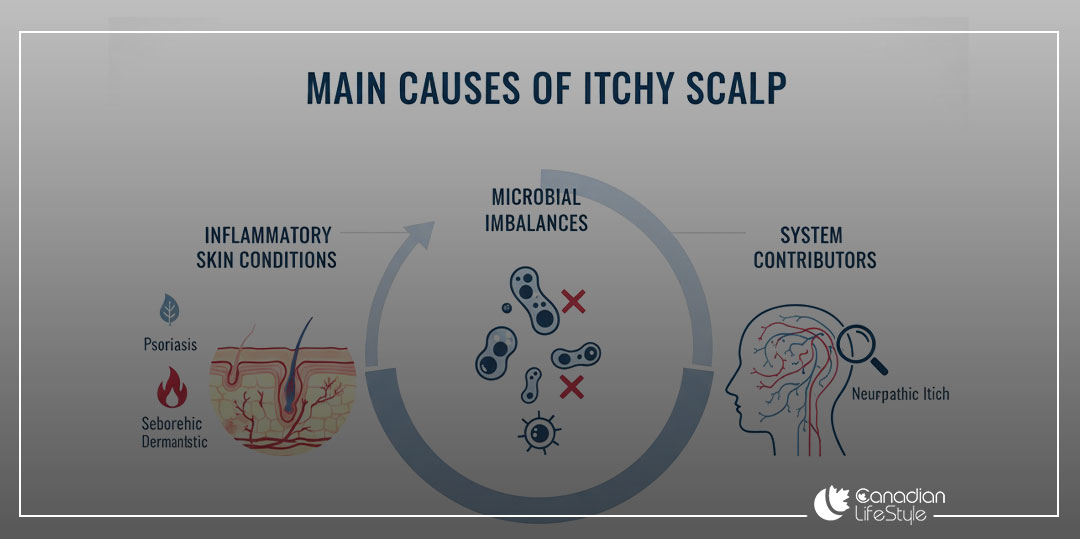 What are the main causes of itchy scalp? What are the main causes of itchy scalp?