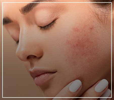 Oily Skin Routine Products and best oily skin routine products