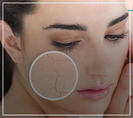 Best skin care products for dry sensitive skin