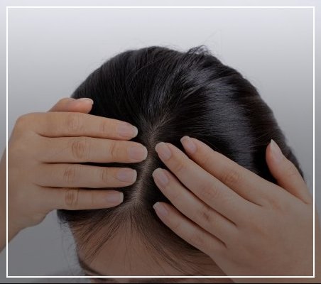 best treatment of scalp diseases
