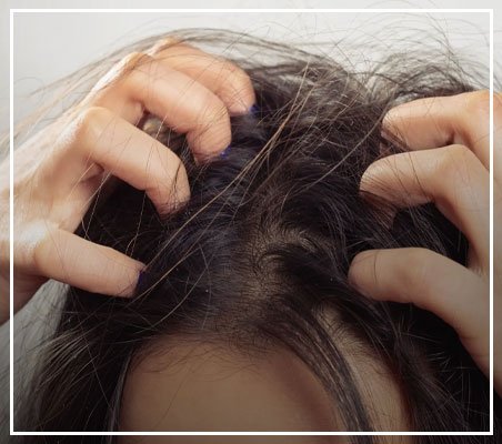 Itchy scalp - causes, treatment and prevention