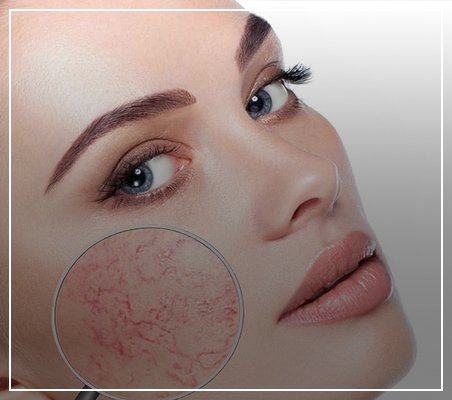 Toners for sensitive skin