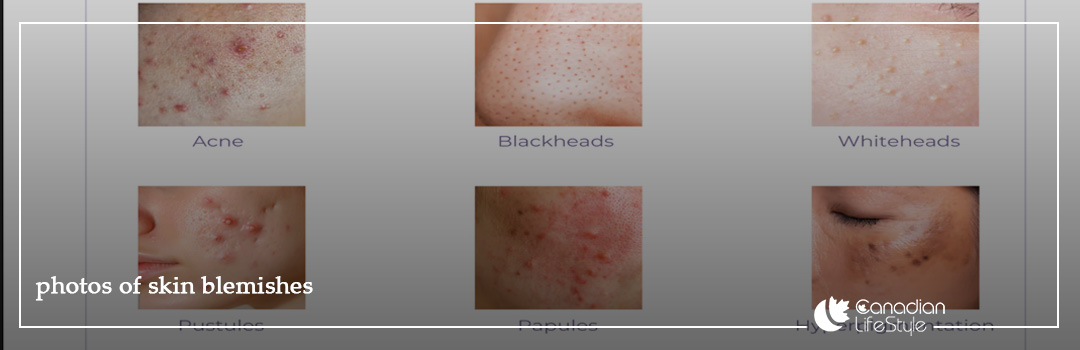 photos of skin blemishes